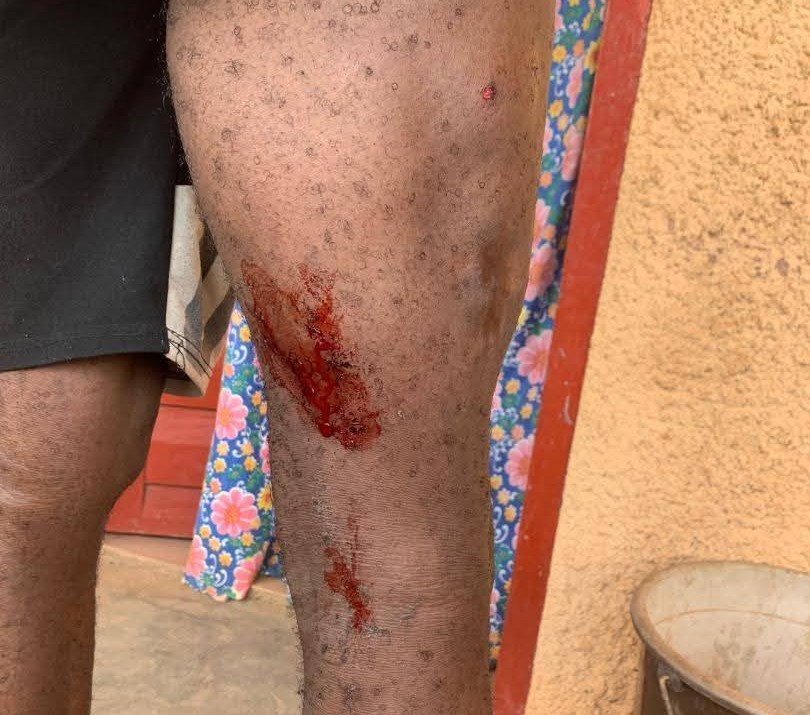 blesses Affrontements à la frontière guinéo-ivoirienne : 4 otages guinéens libérés