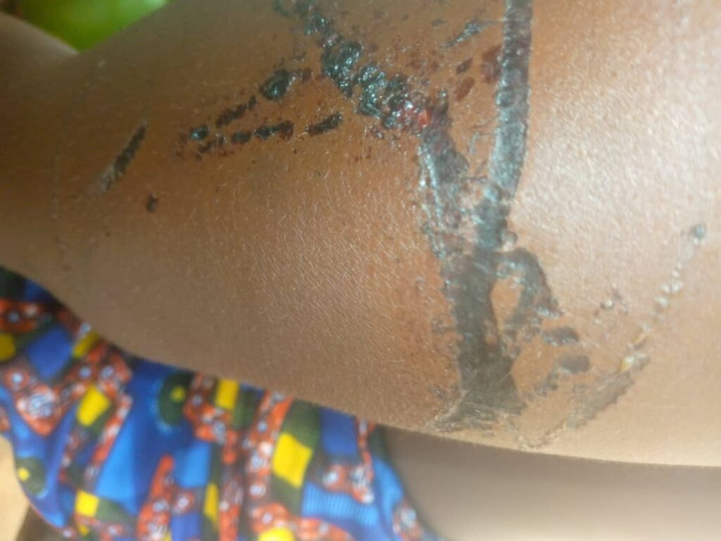 image-90 Bangouya (Kindia) : une femme victime de graves violences conjugales à Sokia