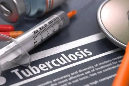 image-76 Tuberculose : de nouveaux vaccins pourraient sauver 7,3 millions de vies d’ici 2050 (Gavi)